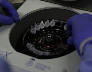 Sobem para 11 os casos suspeitos de infecção pelo novo coronavírus