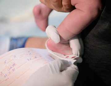 Projeto amplia rol de doenças rastreadas pelo teste do pezinho