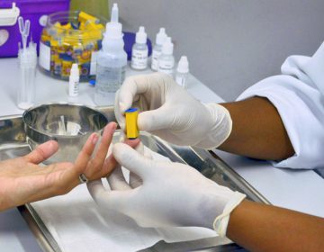 Departamento DST/Aids registra aumento na realização de testes rápidos