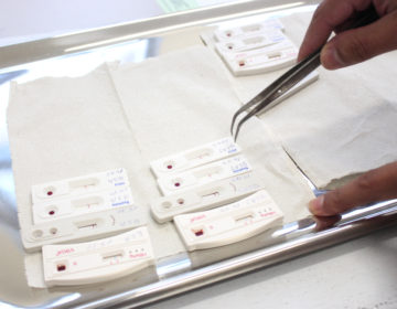 Mais de 100 pessoas iniciaram tratamento do HIV em JF