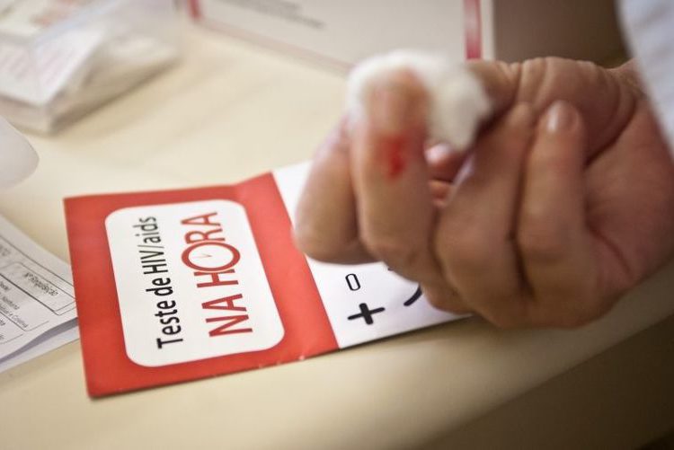 Metas globais para eliminação da aids até 2030 podem não ser cumpridas