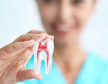 Os mitos e as verdades sobre o dente do siso