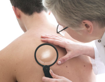 HANSENÍASE: dermatologista fala sobre o tratamento da doença