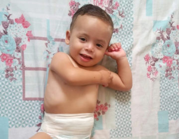 Família lança campanha para ajudar bebê que nasceu com anomalia anorretal