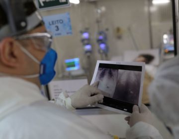 Covid-19: Brasil tem 15.3 mil novos casos; total chega a 218,2 mil