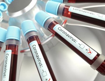 Covid-19: novo boletim feito pela UFJF aponta diminuição da taxa de crescimento dos casos confirmados