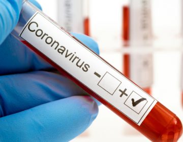 Covid-19: Juiz de Fora totaliza 16.314 casos confirmados e 655 óbitos