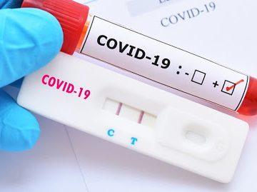Vereadores e coordenador do Protocolo JF dialogam sobre mapeamento de informações no enfrentamento da Covid-19