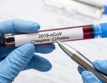 Prefeitura confirma 111 novos casos por Covid-19