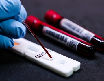 Município obteve 145 novos casos decorrentes do Coronavírus