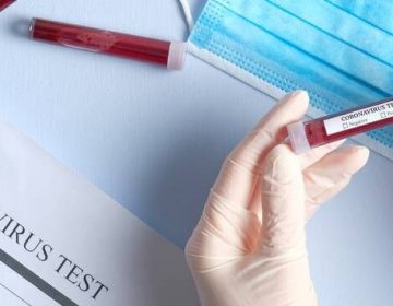 PJF recebe quase quatro mil resultados de exames covid-19 da UFJF