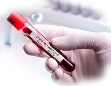 Município registra mais três óbitos por Covid-19; acumulado chega a 730