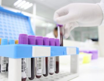 Juiz de Fora tem 5.037 casos confirmados e 174 mortes