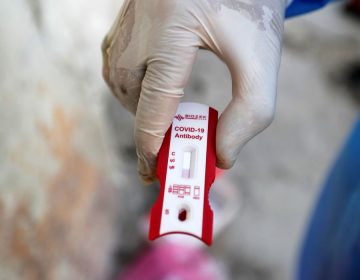 Covid-19: Município tem 4.873 casos confirmados e 162 mortes