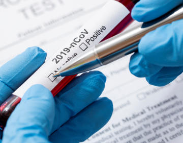 Covid-19: Município acumula 13.843 casos confirmados e 518 vidas perdidas