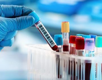 Juiz de Fora registra mais 87 novos casos; total chega a 6.194