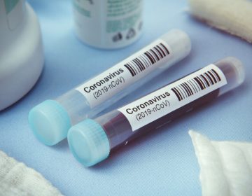 Covid-19: Juiz de Fora ultrapassa a marca de 17 mil casos confirmados