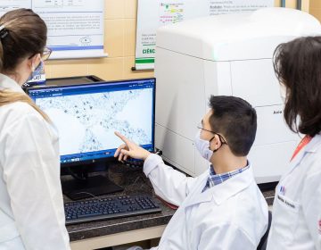 Pacientes mortos pela covid desenvolveram fibrose pulmonar