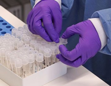 Covid-19: Juiz de Fora acumula 7.190 casos confirmados e 267 óbitos