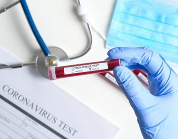 Covid-19: Município tem 8.179 casos confirmados e 283 mortes