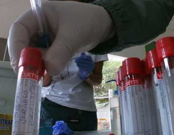 Covid-19: Juiz de Fora registra mais de 100 novos casos, segundo boletim da Secretaria de Saúde