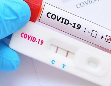 Novo boletim da PJF não registra morte por Covid-19