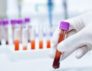 Juiz de Fora tem mais 12 mortes confirmadas por Covid-19