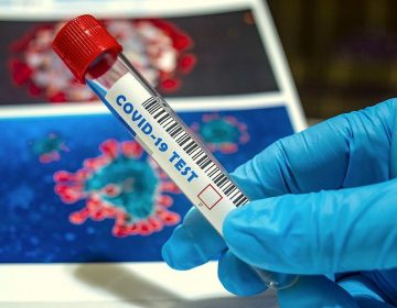 Covid-19: Juiz de Fora totaliza 14.489 pessoas infectadas e 564 mortes