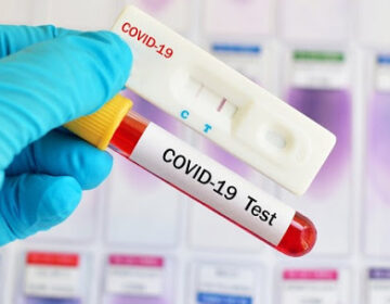 Covid-19: Município registra novo recorde e contabiliza 42 mortes nas últimas 24h