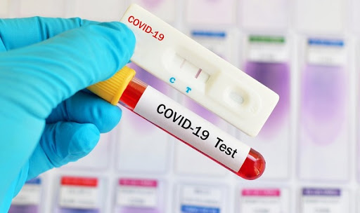 Covid-19: Município registra novo recorde de hospitalizações e passa de 900 mortes