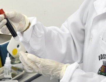 Centro de Testagem e Aconselhamento promove ações contra ISTs