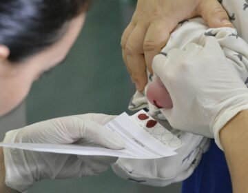 Senado aprova projeto que amplia alcance do teste do pezinho