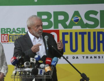 Exames de Lula estão dentro da normalidade, diz boletim médico