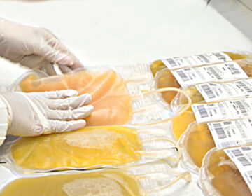 Governo de Minas amplia plasmaférese e fortalece o cuidado contra rejeição de órgãos transplantados